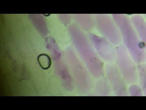 Red Onion Osmosis