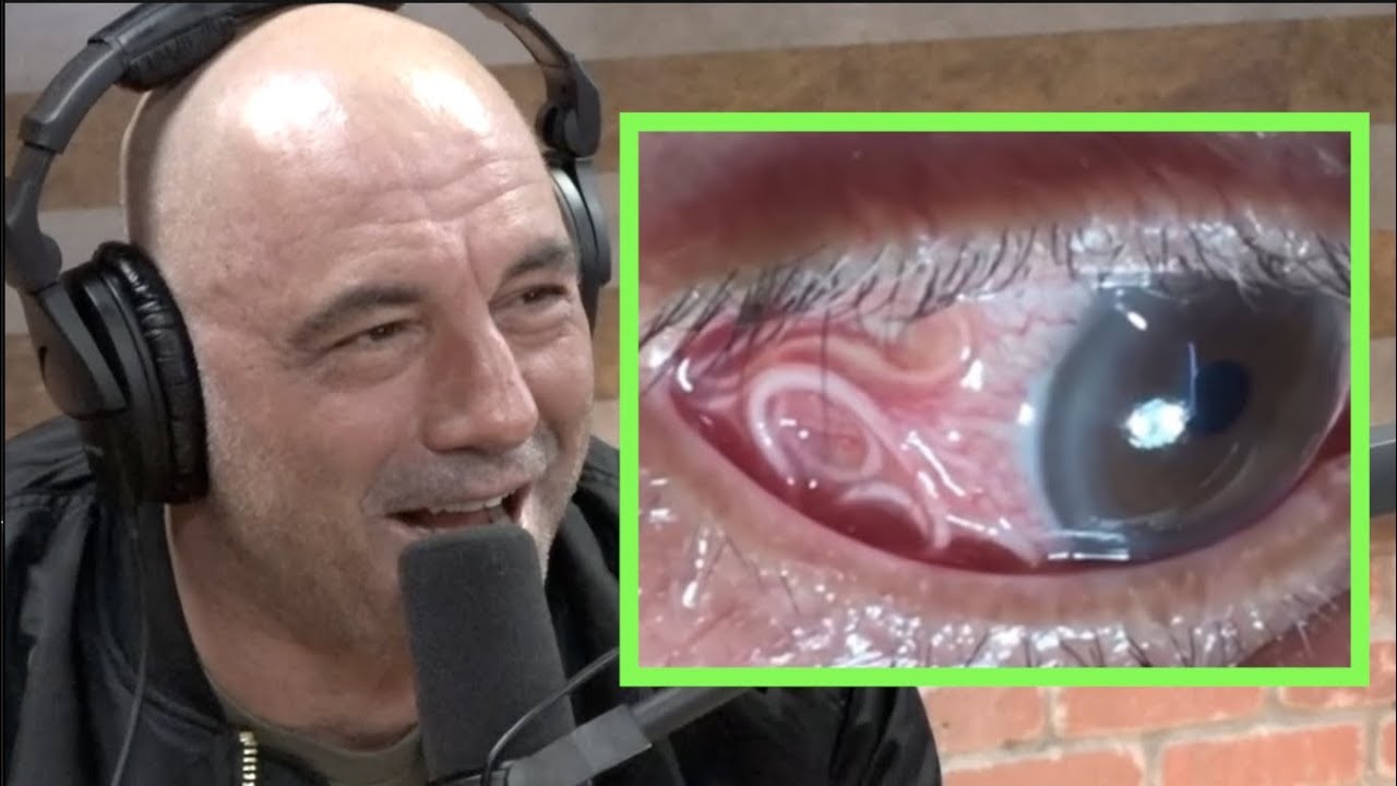 Trichinosis In The Eye 720, 1280 Joe Rogan is HORRIFIED by Parasites in Human Eye! - YouTube
