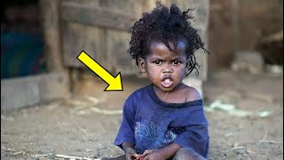 Мужчина удочерил девочку из Сомали, только посмотрите, что с ней стало сегодня!