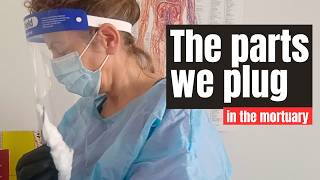 The body parts that we plug in the mortuary