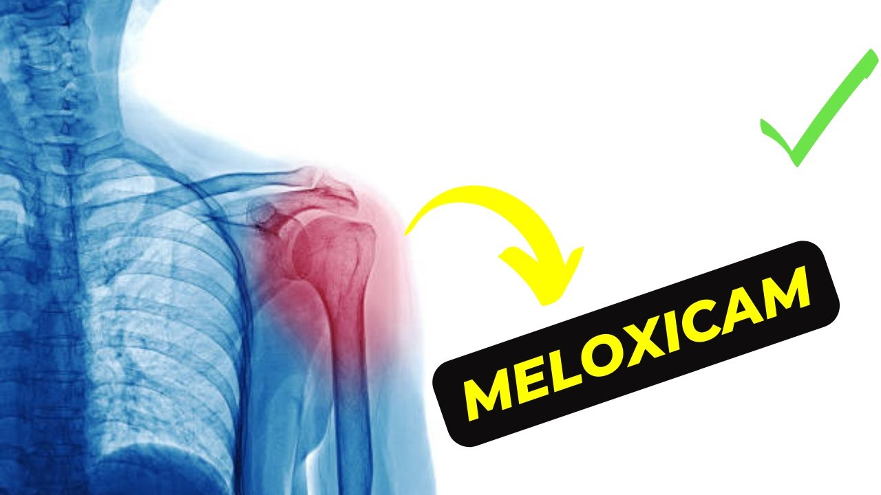 Meloxicam: How It Works, Side Effects, and Optimal Dosage