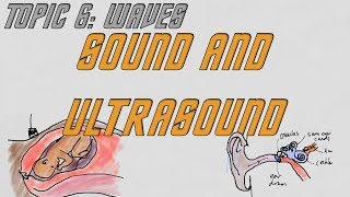 AQA GCSE Physics (9-1): Sound and Ultrasound.