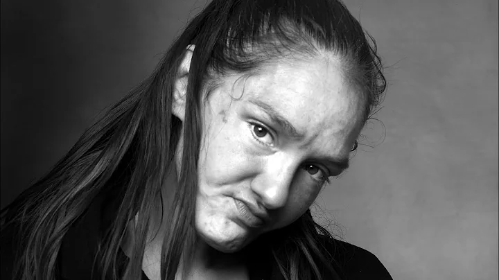 Fentanyl Addict interview-Andrea