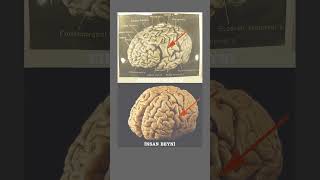 Albert Enşteyn Öləndə Beyni Həqiqətən Oğurlanıb?