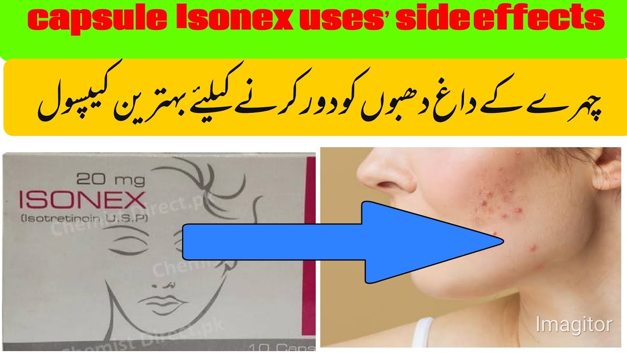 isotretinoin uses, side effects. acne scar treatment capsules. 