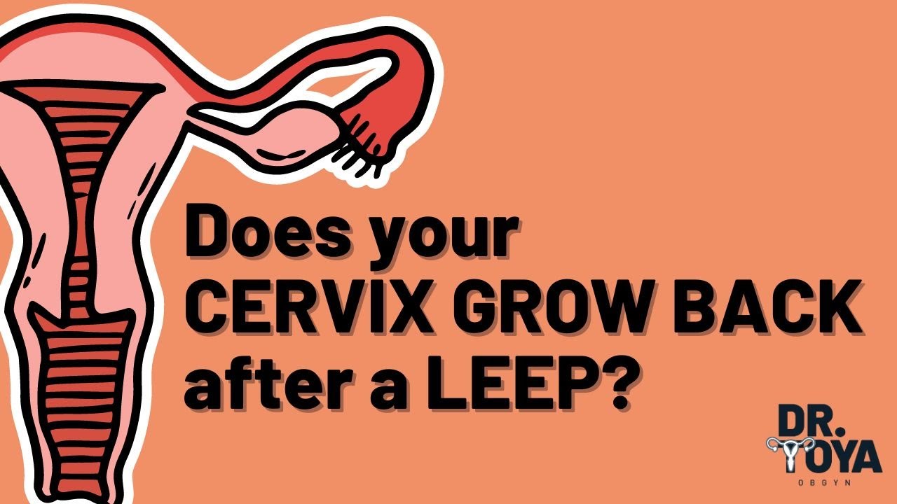 Does Your Cervix GROW BACK After A LEEP YouTube Does Your Cervix GROW BACK After A LEEP YouTube