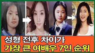 성형 전후 차이가 가장 큰 여배우 7인 순위! 가장 큰 변화 1위 여배우는 누구?