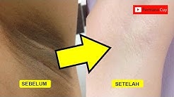 Cara Mudah Memutihkan Ketiak & Selangkangan - Durasi: 5.30. 