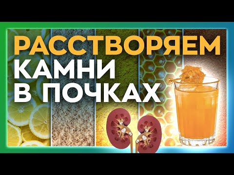 Как вывести камни в почках и желчном пузыре?  Коктейль от камней в почках