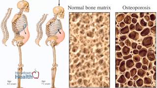 Center For Medical Imaging - No Bones About It