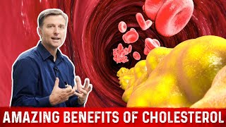 Cholesterol Function – Amazing Benefits of Cholesterol – Dr. Berg Wealth