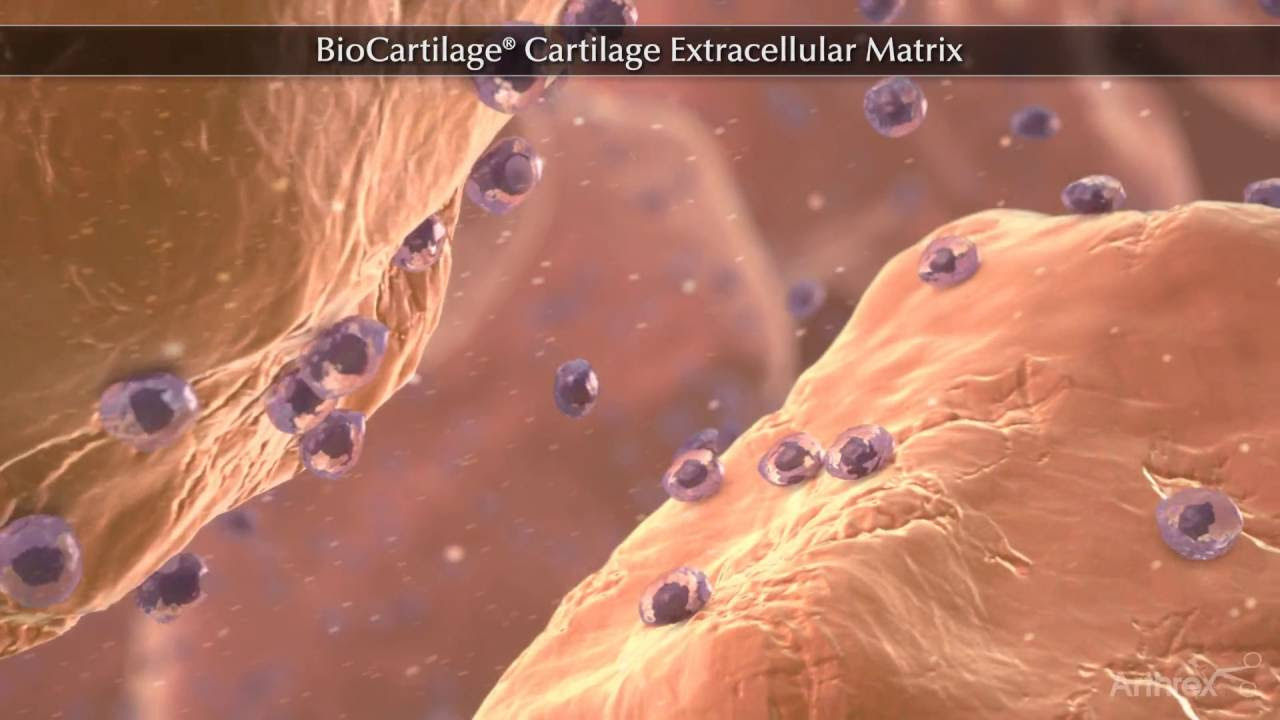 The Rubbery Matrix of Cartilage is Secreted By [The Secret to Joint ...