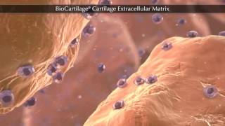 BioCartilage® Cartilage Extracellular Matrix