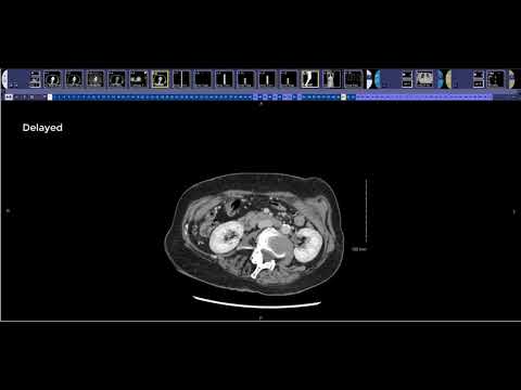 How to read a pancreas CT