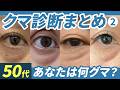 【50代必見】もう老け顔に悩まない!目の下のたるみ・クマ診断Part2|複数のプロが教える「若返り」の正解とは?#クマ取り #目の下のクマ #裏ハムラ #脂肪注入#美容整形#湘南美容クリニック