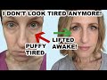 GET RID OF EYE BAGS AND PUFFINESS IN MINUTES!