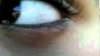ojo feo