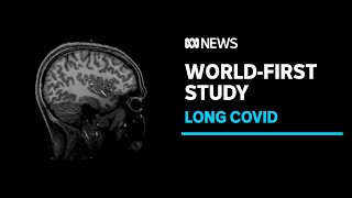 Similarities identified in chronic fatigue syndrome and long COVID | ABC News