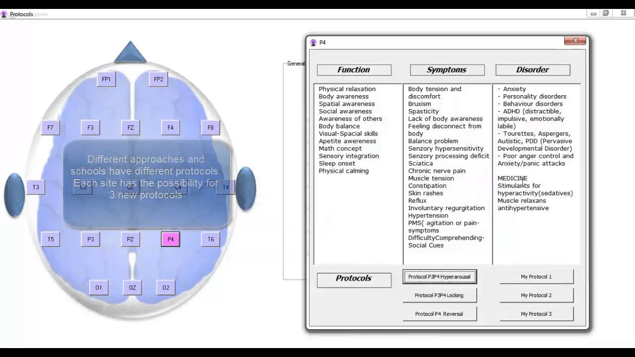 Neurofeedback Protocols Guide 