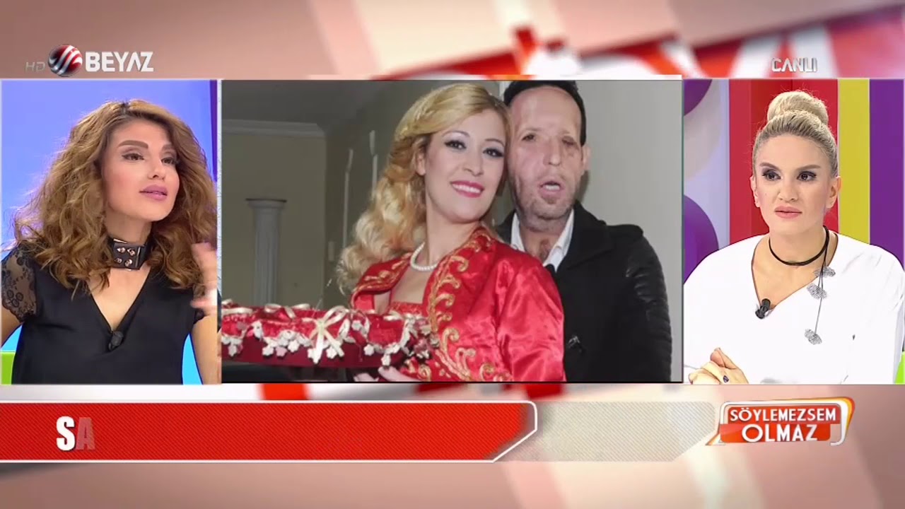 Yüz nakli yapılan Recep Sert hangi borcu yüzünden tutuklandı YouTube