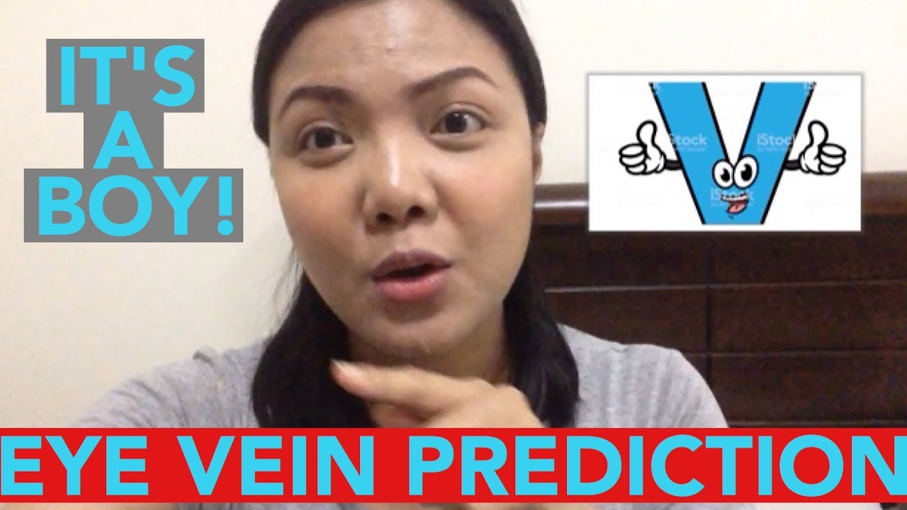 IT'S A BOY!!! | EYE VEIN GENDER PREDICTION.