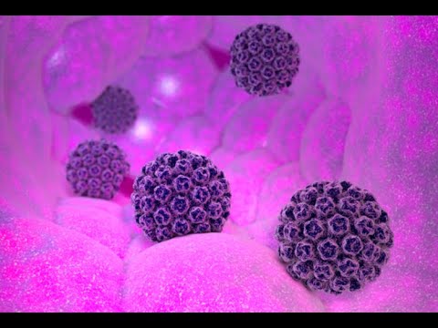 Vidéo: Le Composant Hippo YAP Se Localise Dans Le Noyau Du Carcinome épidermoïde Oropharyngé Positif Au Virus Du Papillome Humain