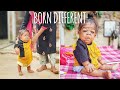 The 26-Year-Old Trapped In A Toddler's Body | BORN DIFFERENT