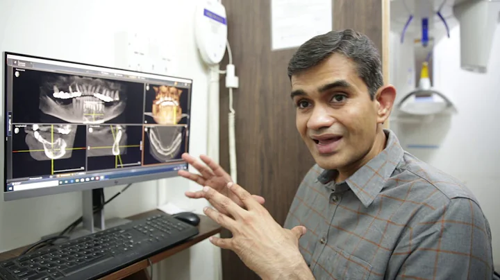 Digital Workflow in Implants  - Watch Dr Arunkumar Pearls Dentistry Chennai explaining on Digital WF
