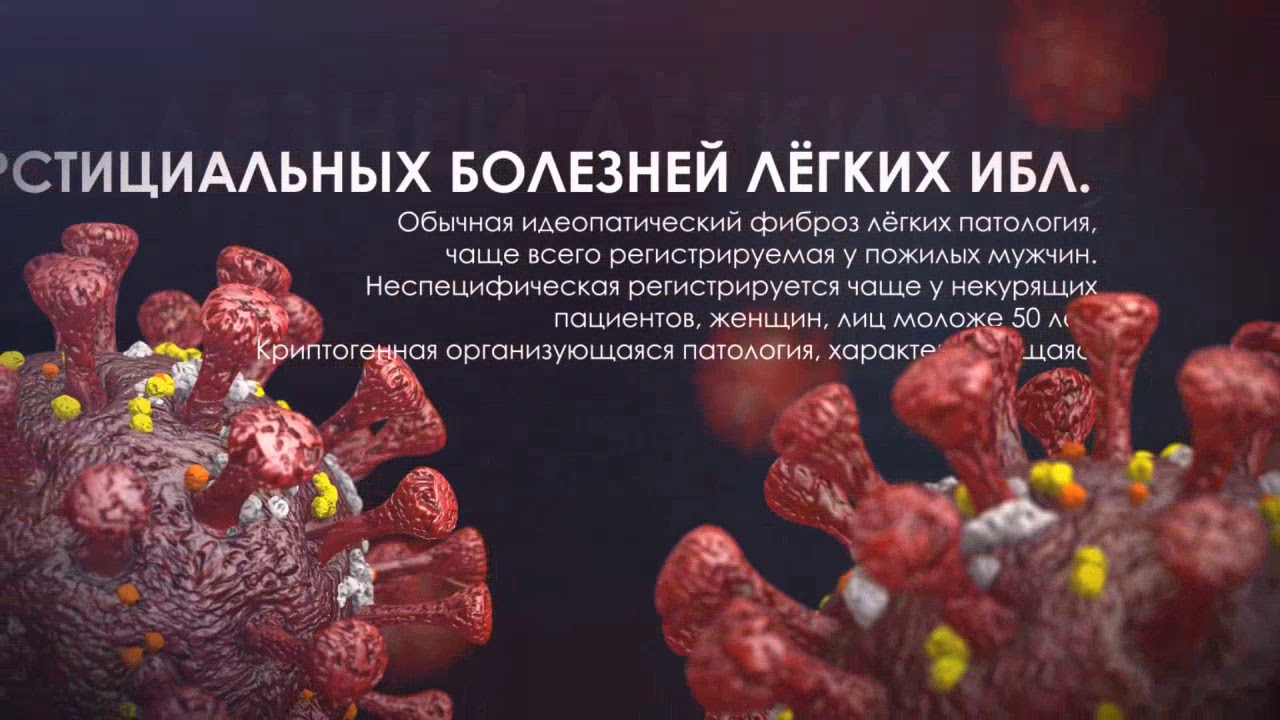 Интерстициальная пневмония лечение