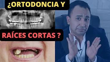 ¿Pueden volver a crecer las raíces de los dientes?