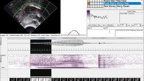 AAA219 Annotation with hotlists