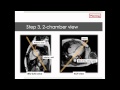 Why CMR Webinar: Introduction into scanning and planning for CMR