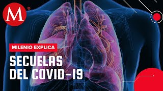 ¿Cómo rehabilitar los pulmones después del covid19? | Milenio Explica