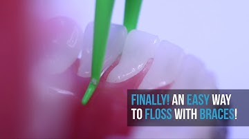 The Harp Flosser - Orthodontic Flossing Tool