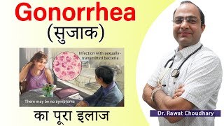 Gonorrhoea (गोनोरीए) या सुजाक Best Treatment | The Clap Drip Best Treatment | Best Homeopathy Doctor