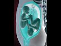Twins struggles inside the Womb for supremacy (3D Animation)