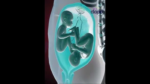 Twins struggles inside the Womb for supremacy (3D Animation)