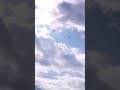 تنحط عالجرح يبرى تنحط عالجرح يبرى