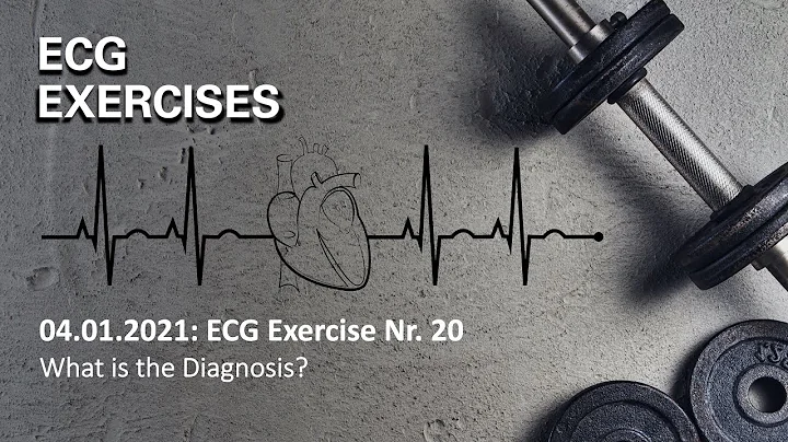 ECG Exercise Nr.20: A young man with wide QRS complex tachycardia