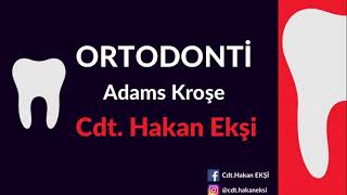 Ortodonti Adams Kroşe Bükümü #orthodontics #ortodonti