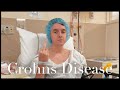 Living with crohns disease  my experience after 4 years