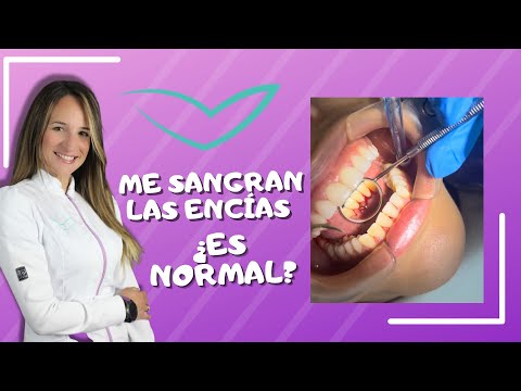 Video de la Dra. Verónica: Mira el video: me sangran las encías, ¿es normal?