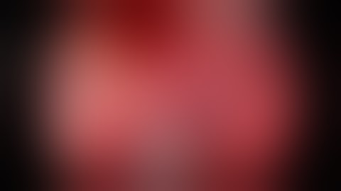 Uniportal trisegmentectomy (Lingula sparing left upper lobectomy)