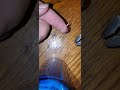 Enormous Splinter removal