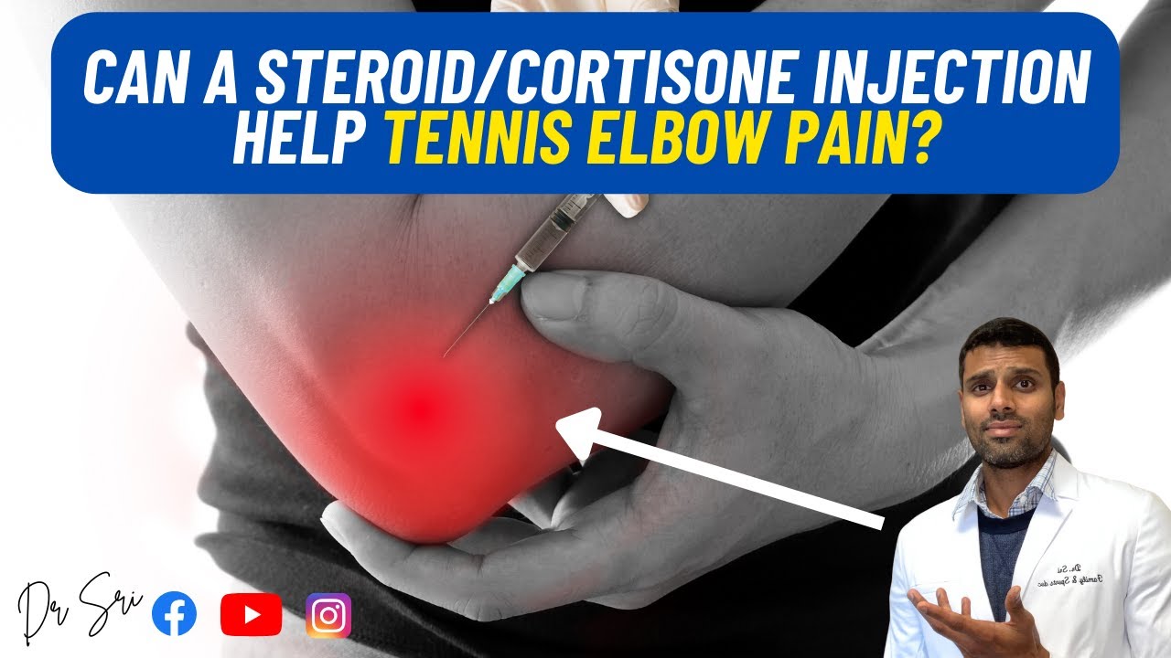 Does Steroid Injection Help Tennis Elbow Sports MD Evidence Based Does Steroid Injection Help Tennis Elbow Sports MD Evidence Based