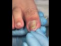 Satisfying Pedicure Routine | Gentle Toenail Care  #fypシ #fypシ #pedicure #nailcare