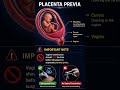 Placenta Previa #pregnancy #pregnancyeducation
