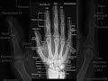 MEDICAL FLASHCARDS #NEETPG #AIIMS #FMGE #trending #viral #shorts #reels #music #video #gaming #fyp
