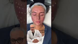 Just because it’s trending doesn’t mean it’s safe #laserclinique #bbglow #bbglowtreatment