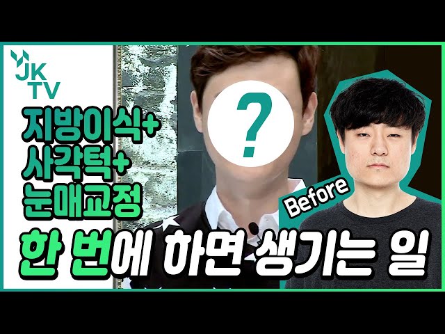 💜남자성형💜 잘생겨지는 건 내 자유니까 🙋♂